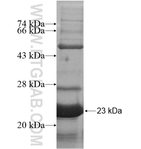 EID2B fusion protein Ag11480 SDS-PAGE EID2B fusion protein Ag11480 SDS-PAGE