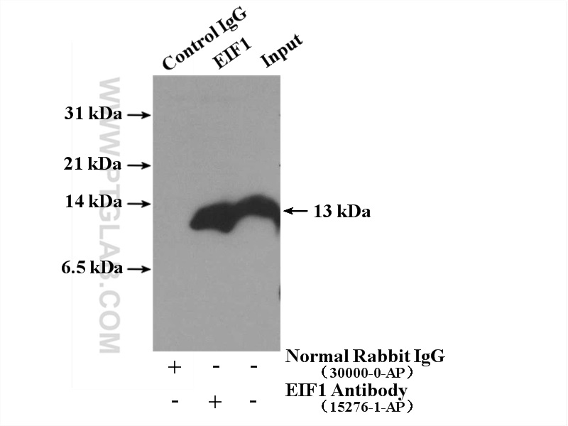 IP experiment of Jurkat using 15276-1-AP