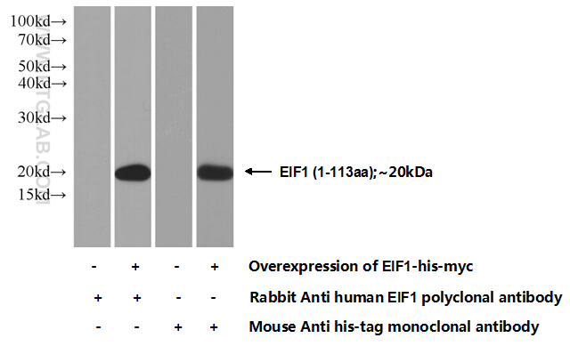 EIF1