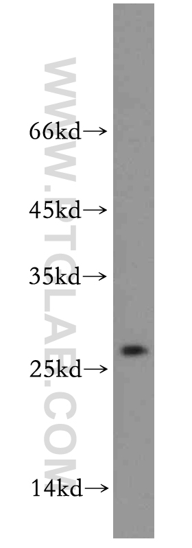 WB analysis of K-562 using 20528-1-AP