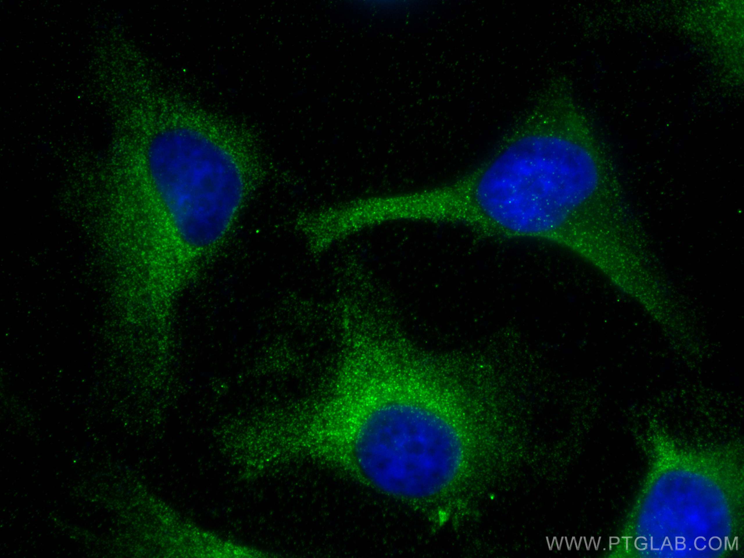 IF Staining of HeLa using 11649-2-AP