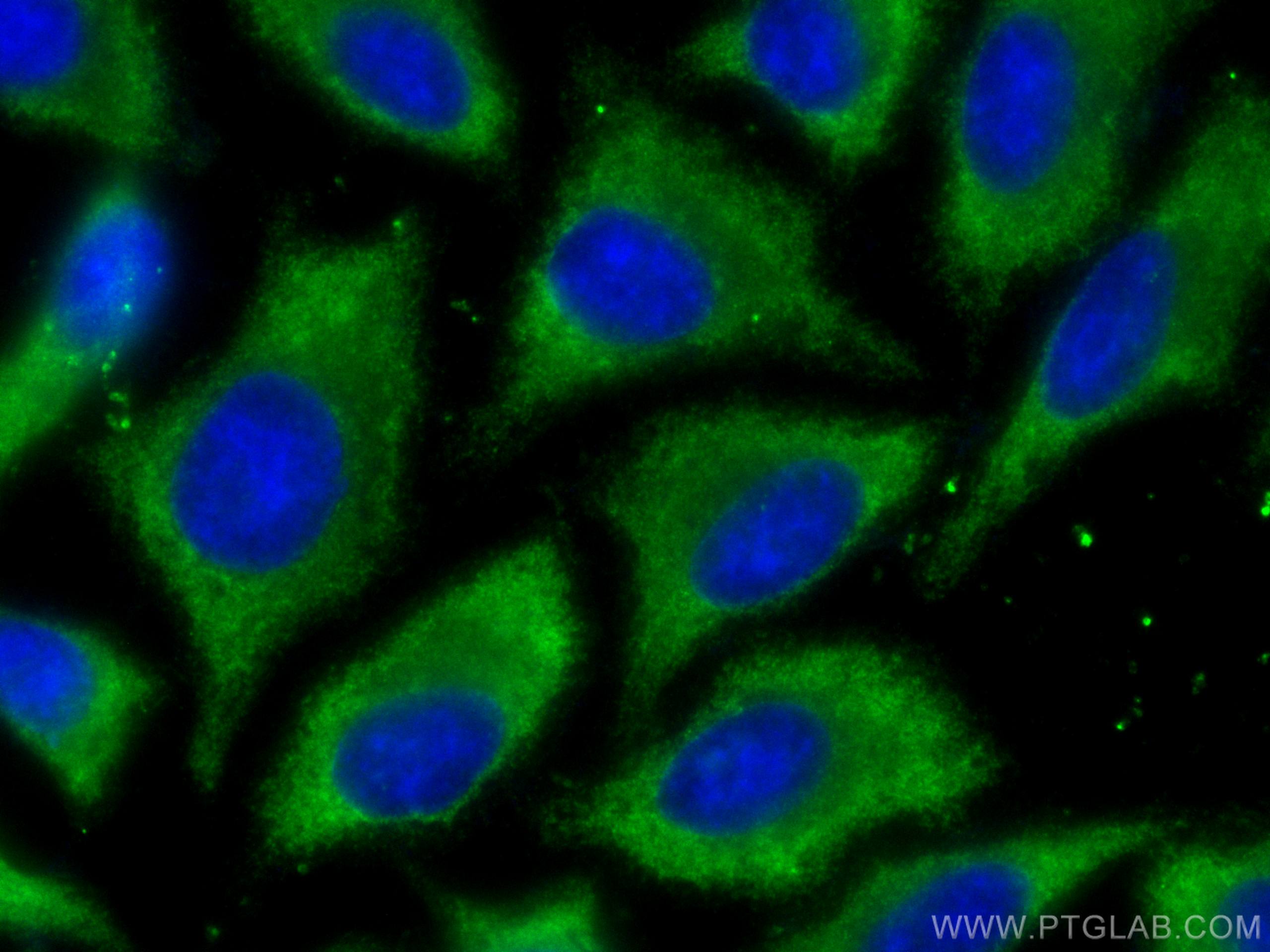 IF Staining of HepG2 using 11233-1-AP