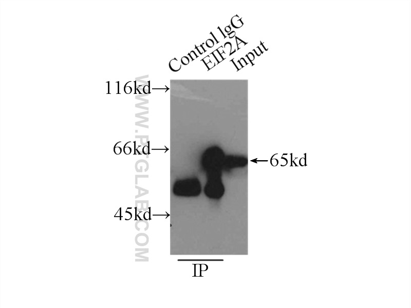 IP experiment of MCF-7 using 11233-1-AP