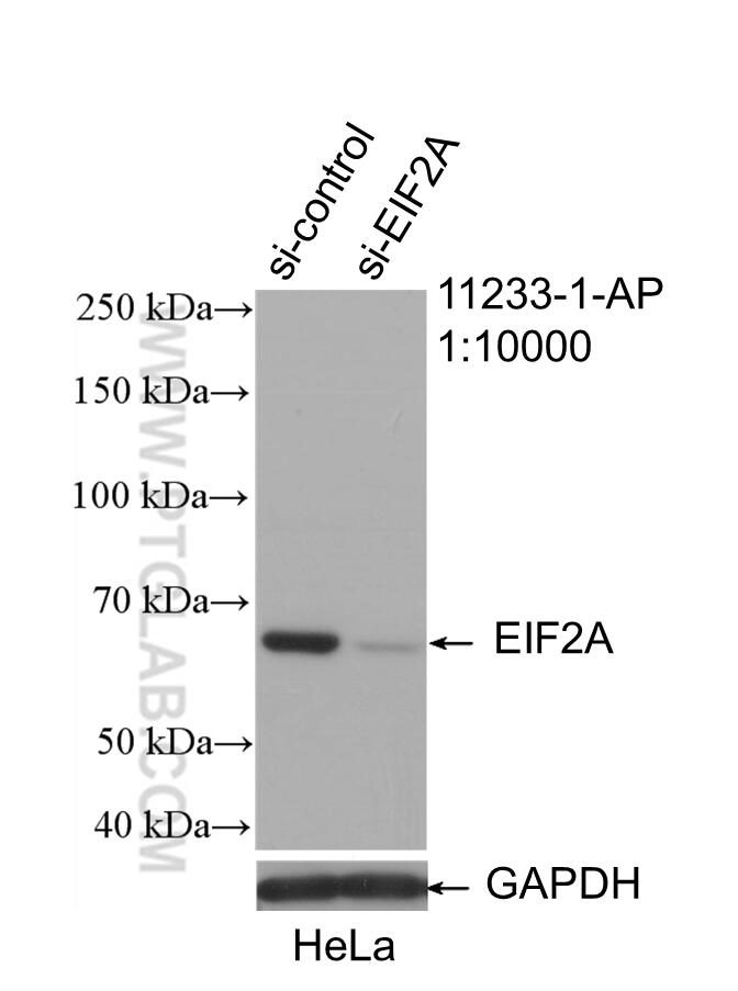 WB analysis of HeLa using 11233-1-AP