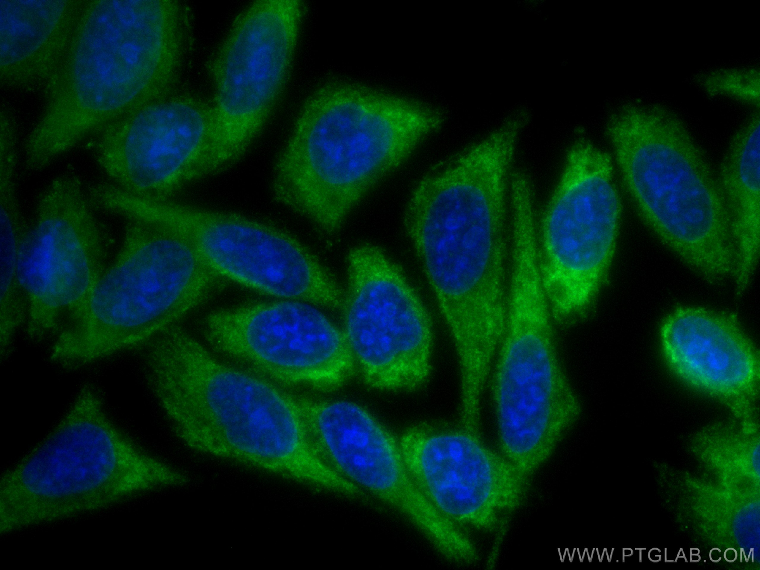 IF Staining of HepG2 using 66482-1-Ig