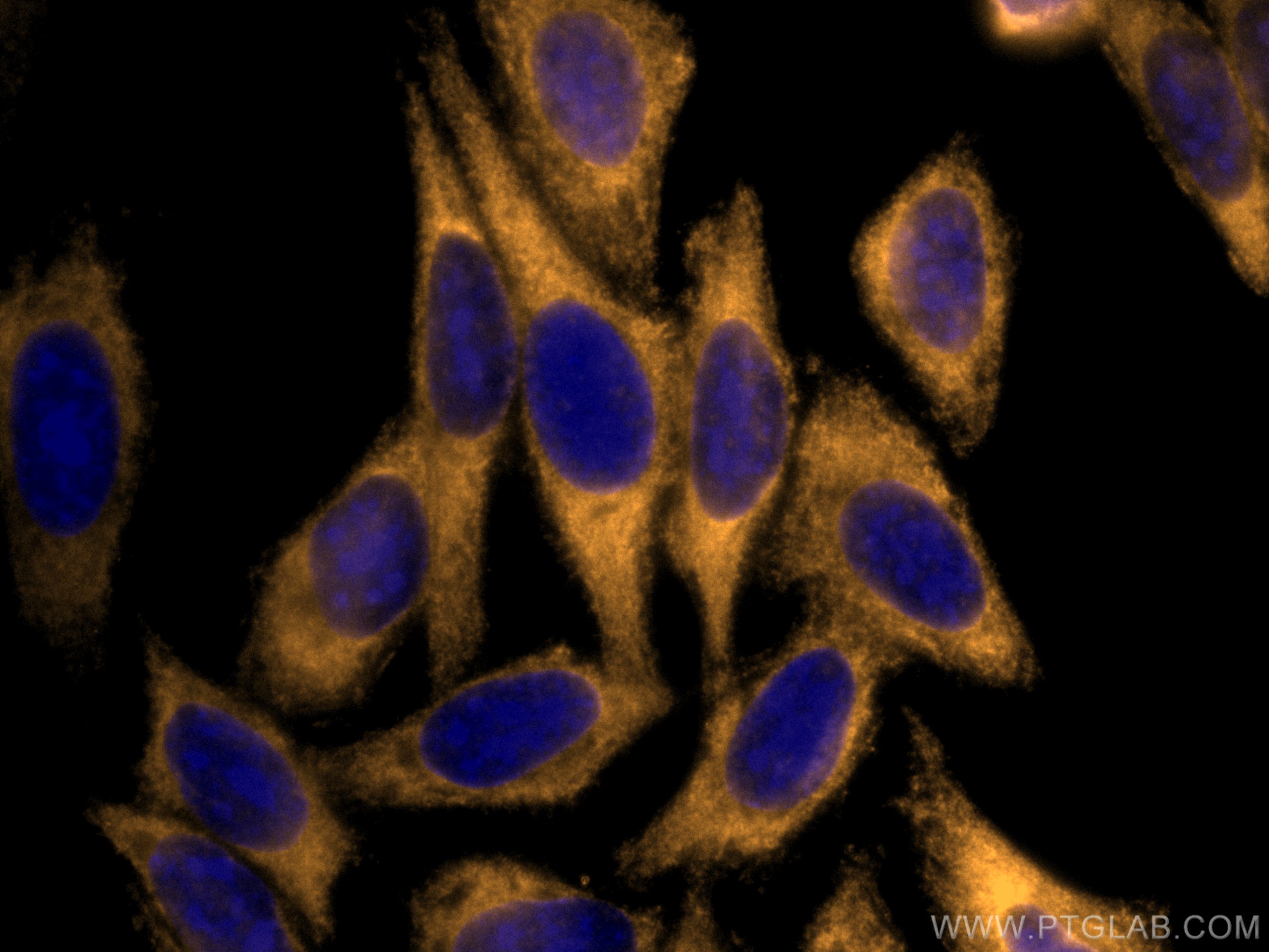 IF Staining of HepG2 using CL555-66482