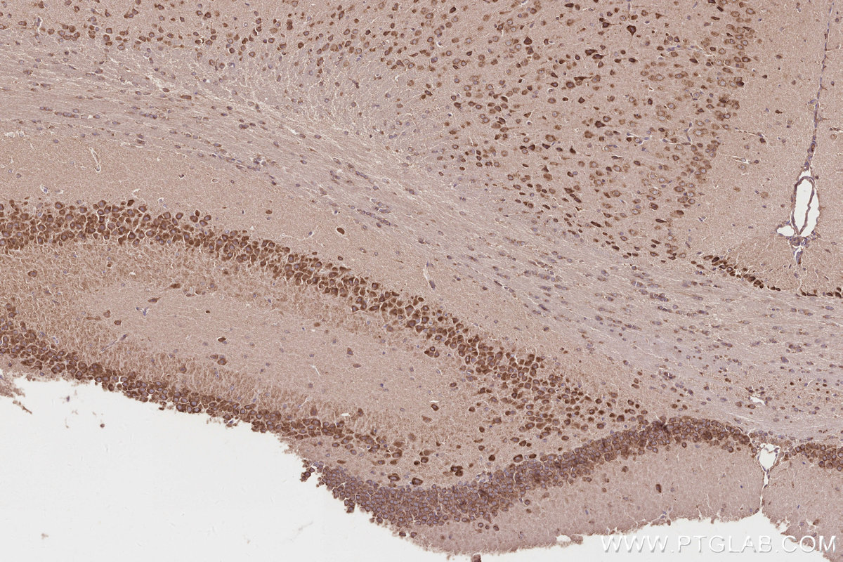 IHC staining of mouse brain using 67674-1-Ig IHC staining of mouse brain using 67674-1-Ig