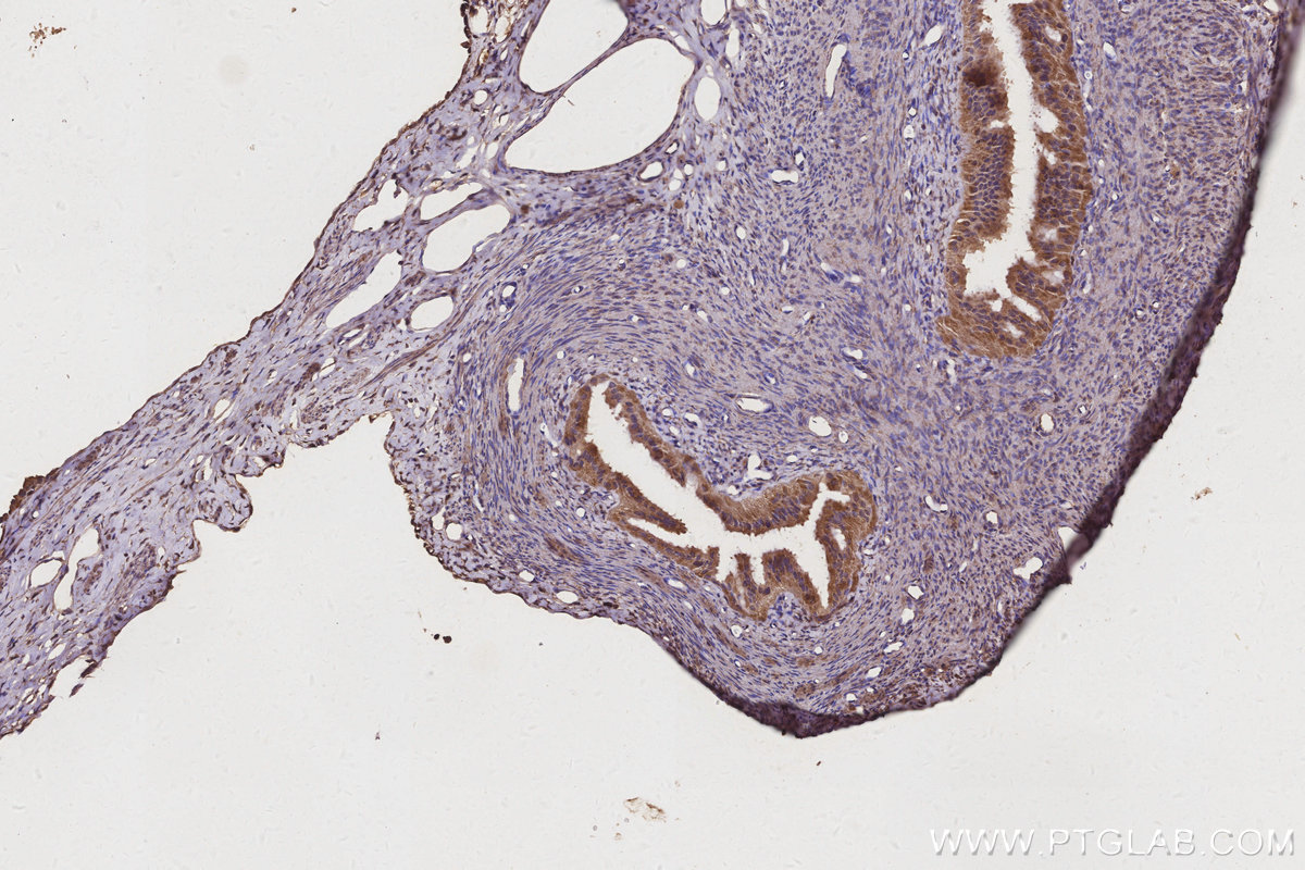 IHC staining of rat ovary using 67674-1-Ig IHC staining of rat ovary using 67674-1-Ig