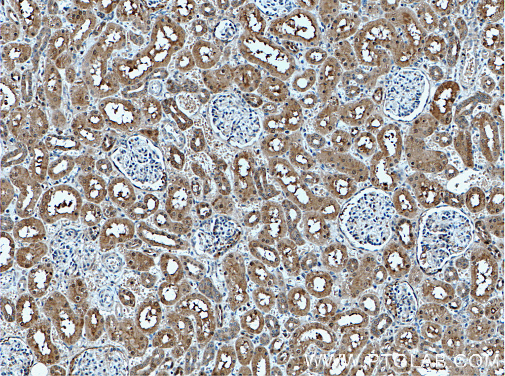 IHC staining of human kidney using 18244-1-AP