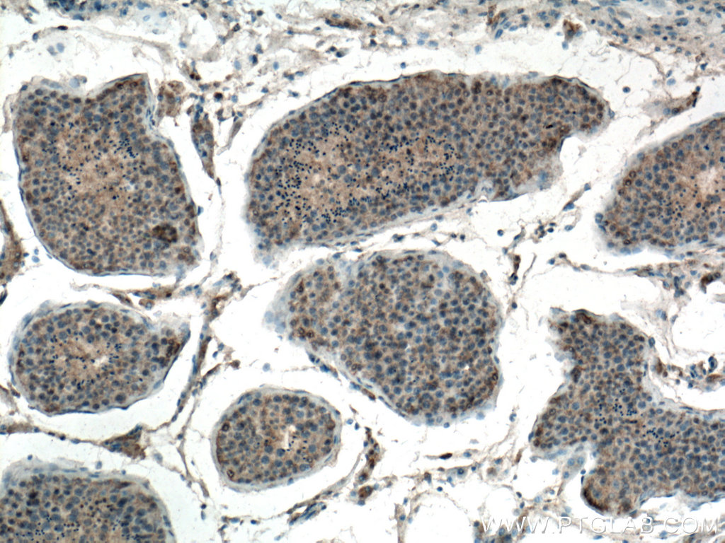 IHC staining of human testis using 66646-1-Ig