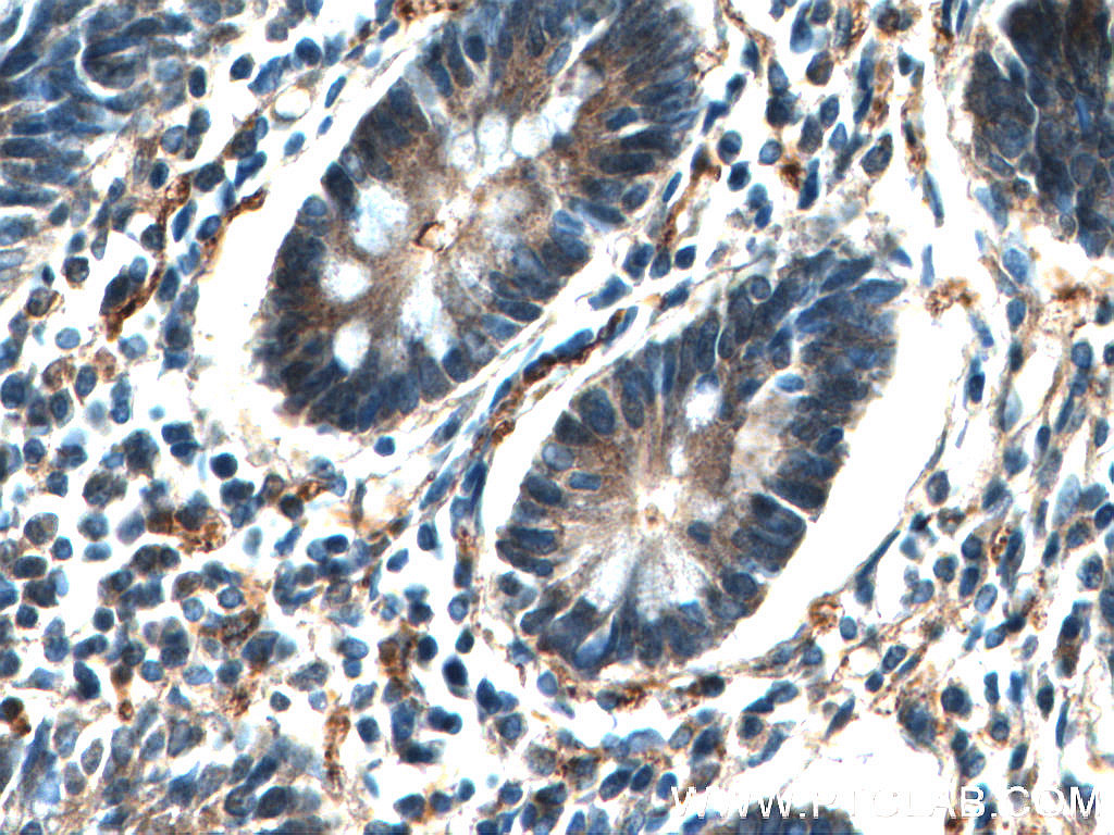 IHC staining of human small intestine using 27944-1-AP