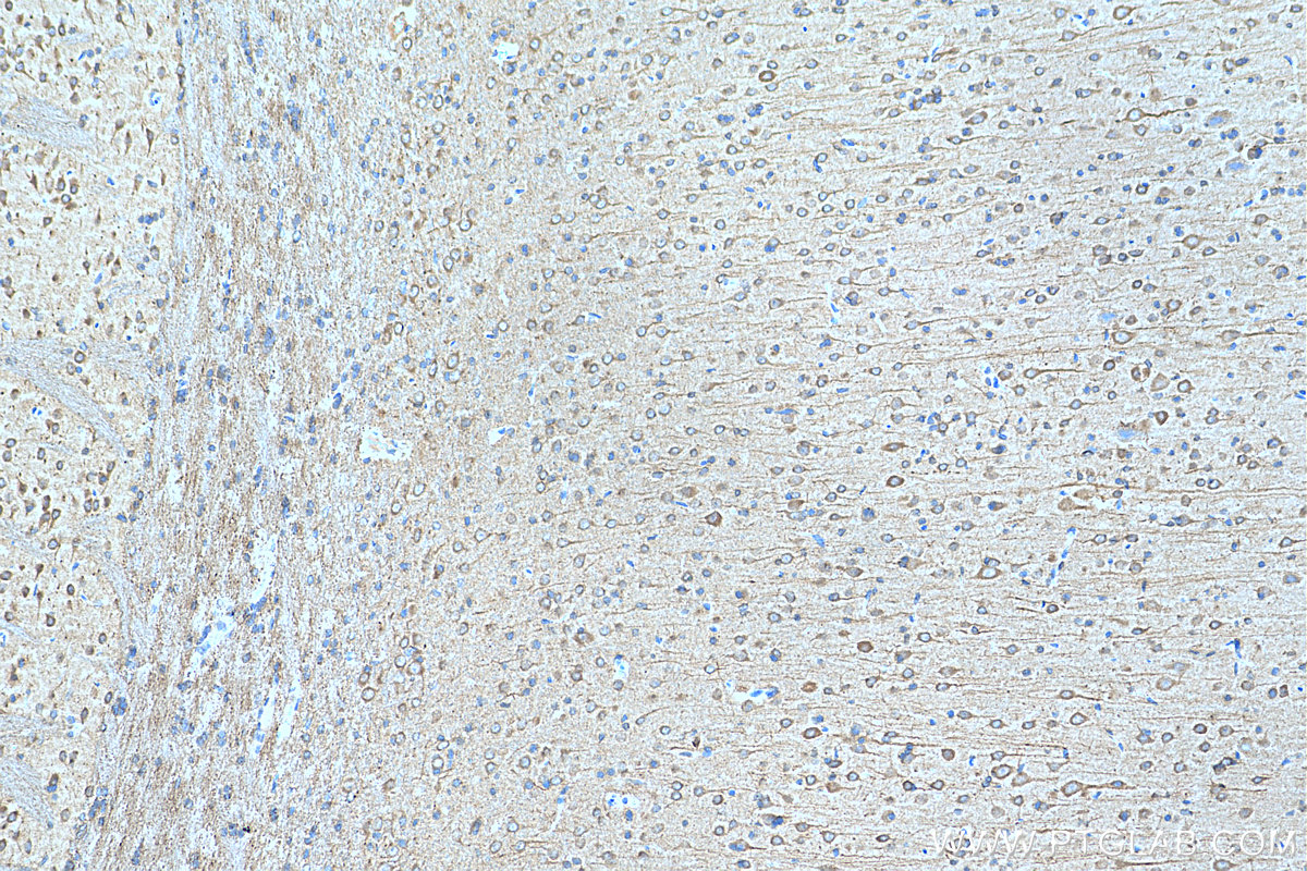 IHC staining of rat brain using 11034-1-AP