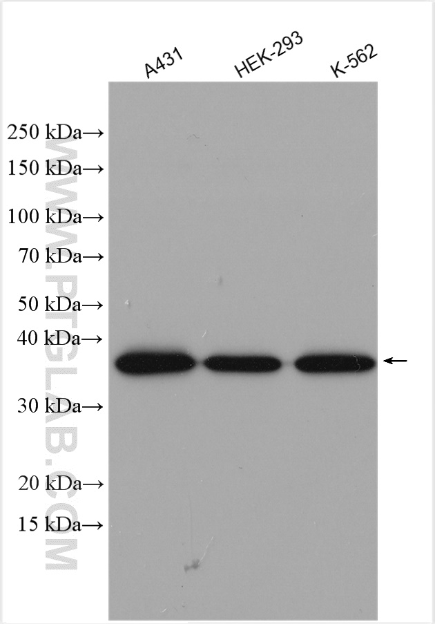 WB analysis using 11034-1-AP