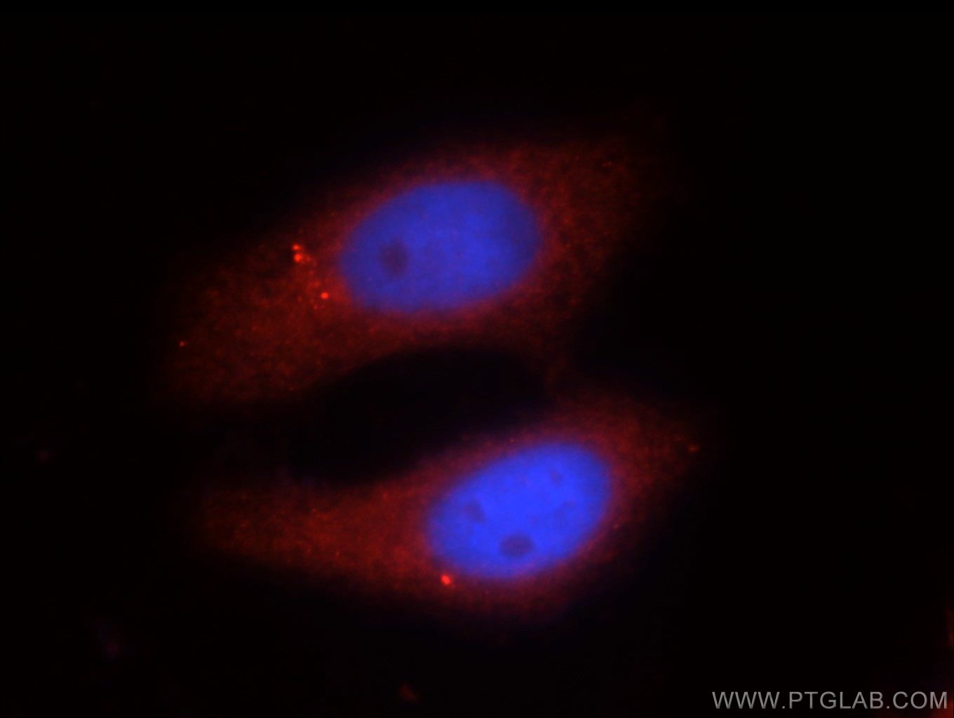 IF Staining of HepG2 using 19690-1-AP (same clone as 19690-1-PBS)