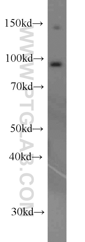 WB analysis of HeLa using 19690-1-AP (same clone as 19690-1-PBS)