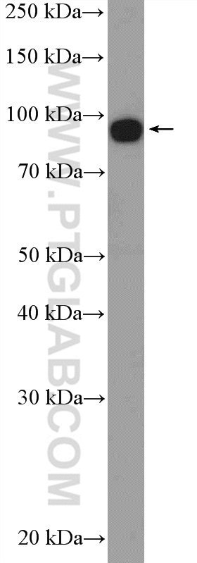 WB analysis of SKOV-3 using 19692-1-AP (same clone as 19692-1-PBS)