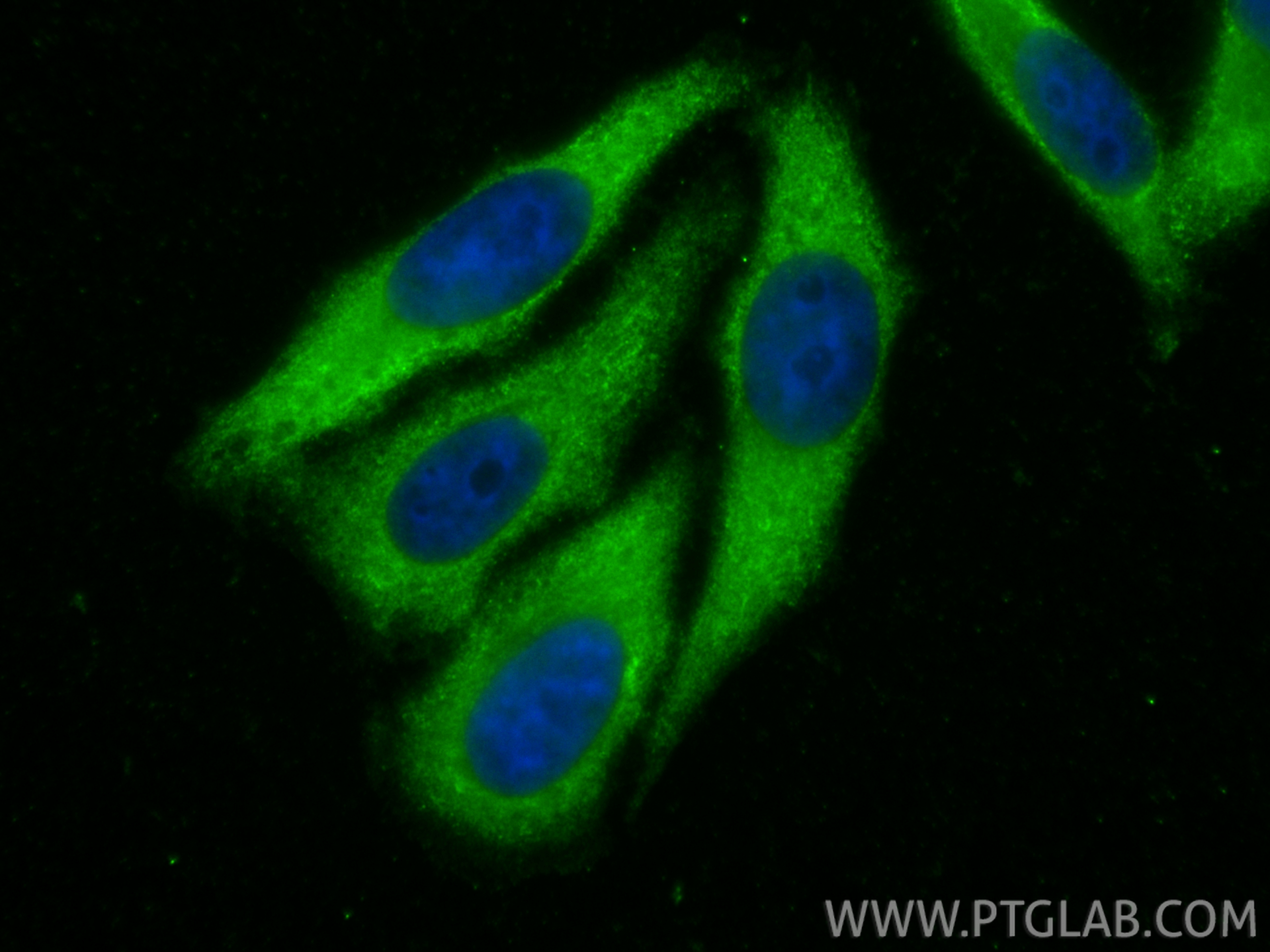 IF Staining of HepG2 using 11170-1-AP