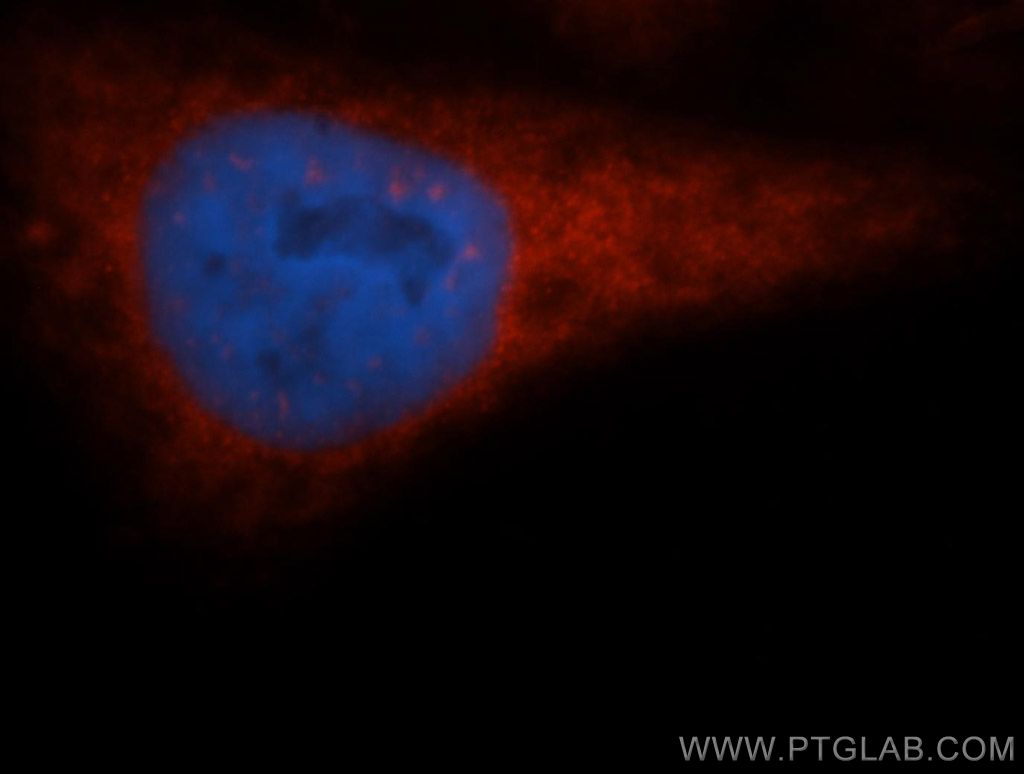 EIF2S1 Polyclonal antibody