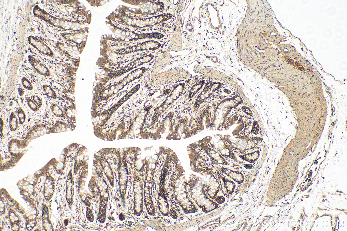 IHC staining of rat colon using 11170-1-AP