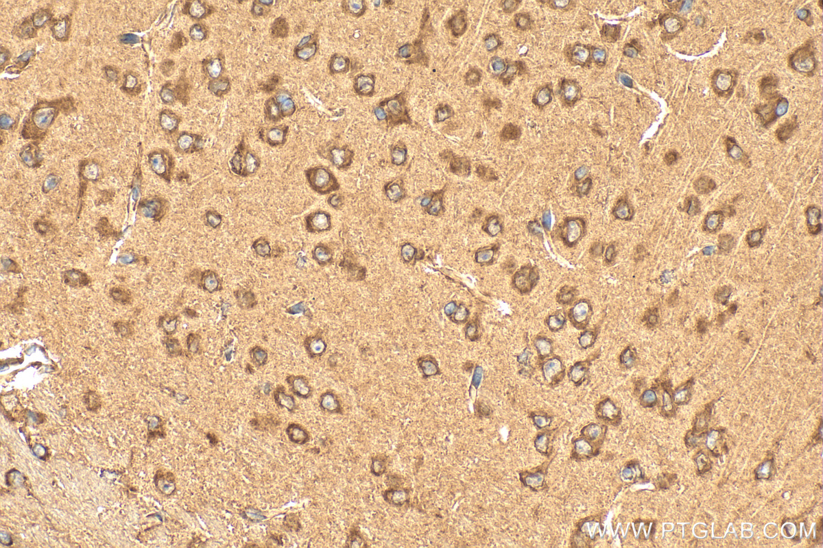 IHC staining of mouse brain using 11170-1-AP