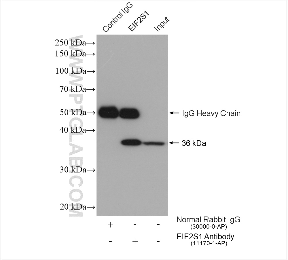 IP experiment of HepG2 using 11170-1-AP