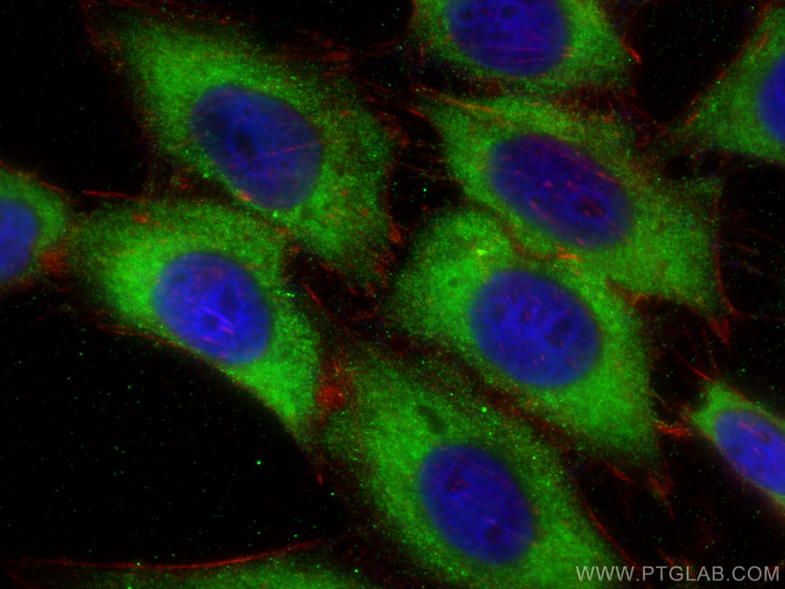 IF Staining of HepG2 using 68479-1-Ig (same clone as 68479-1-PBS)