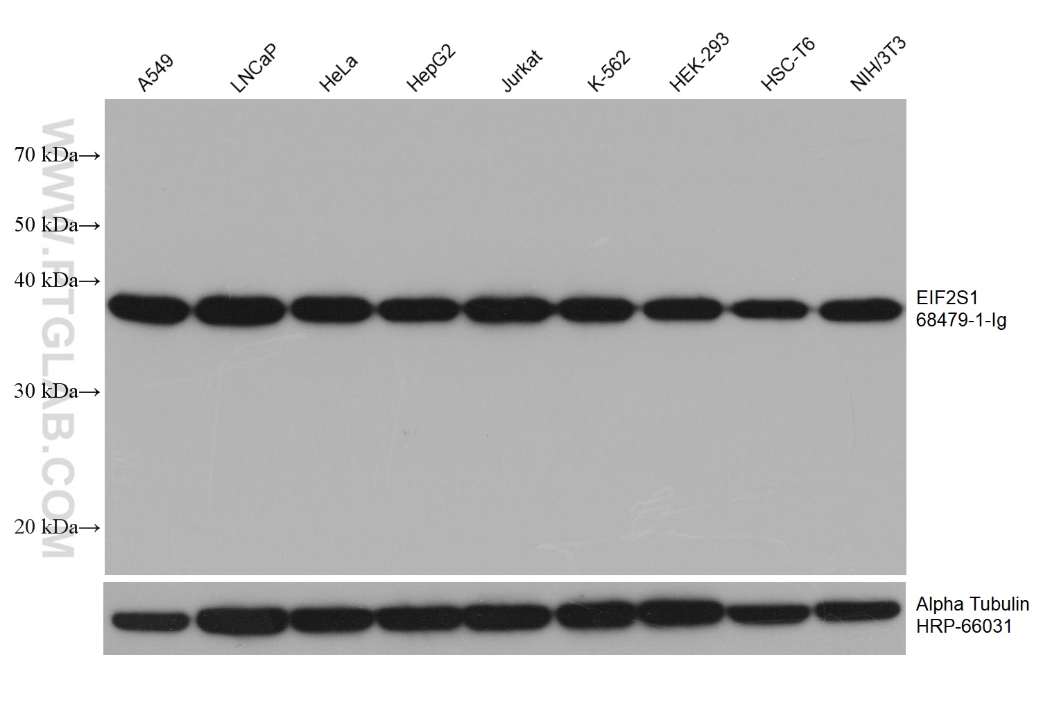 WB analysis using 68479-1-Ig (same clone as 68479-1-PBS)