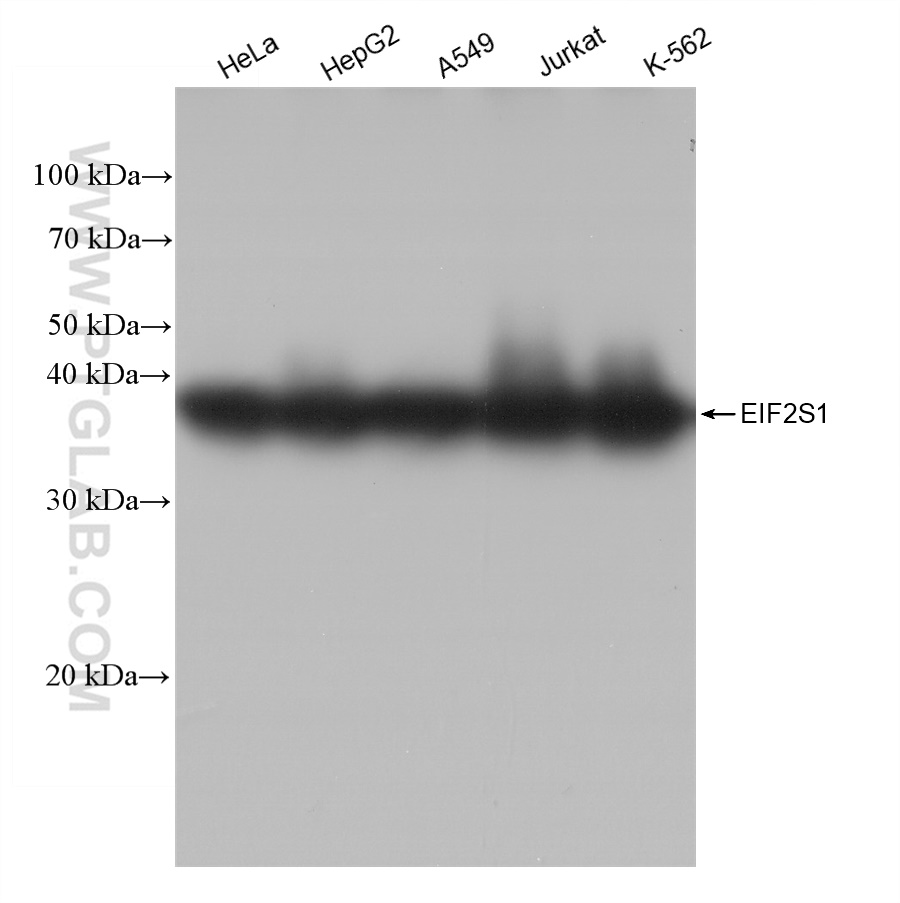 WB analysis using 82936-1-RR (same clone as 82936-1-PBS)