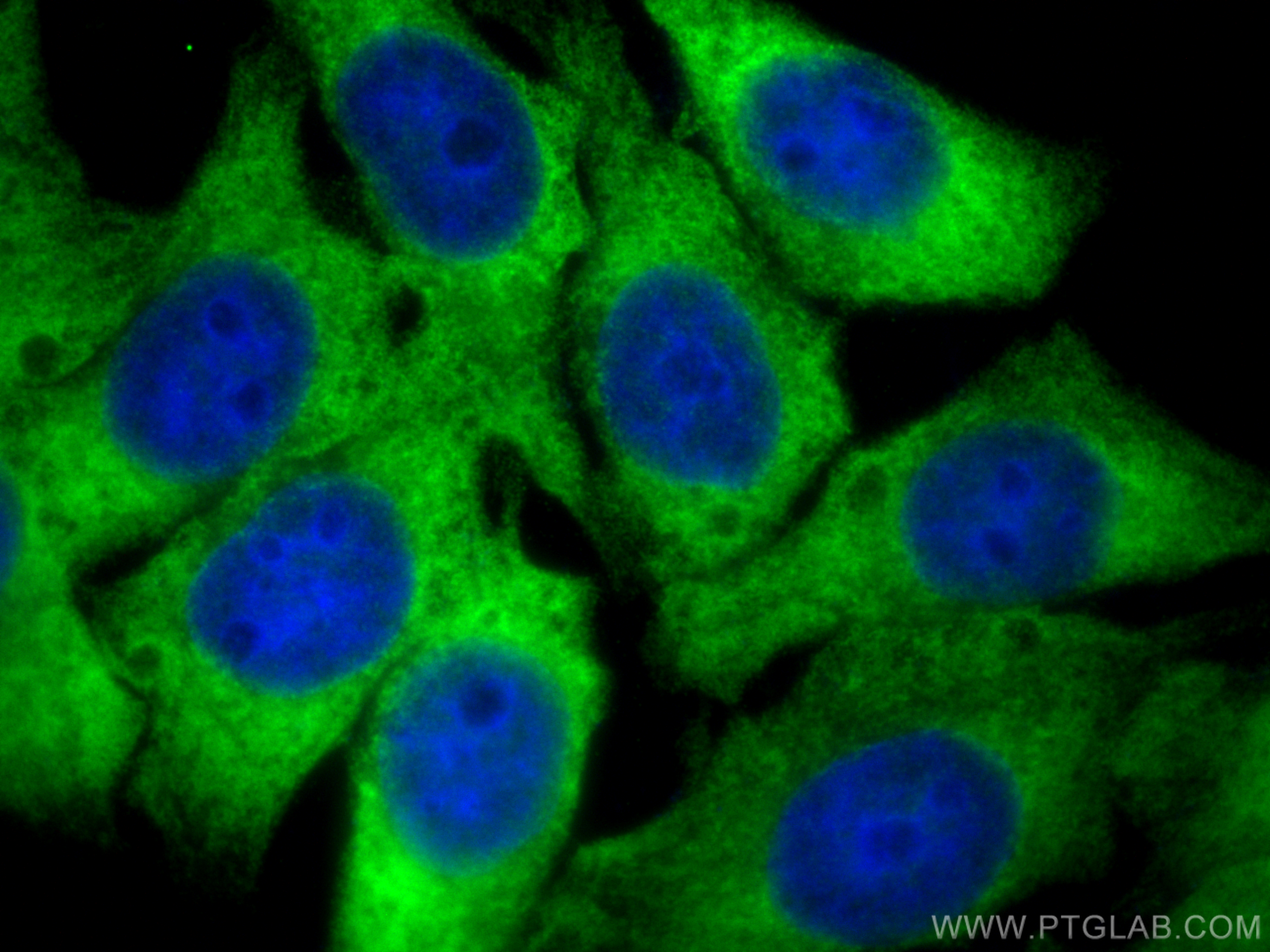 IF Staining of HepG2 using RMX00004