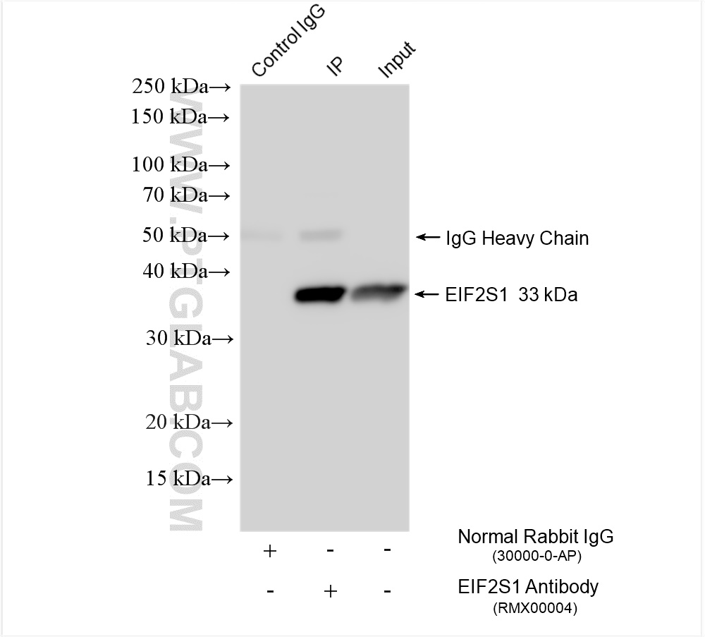 IP experiment of HepG2 using RMX00004
