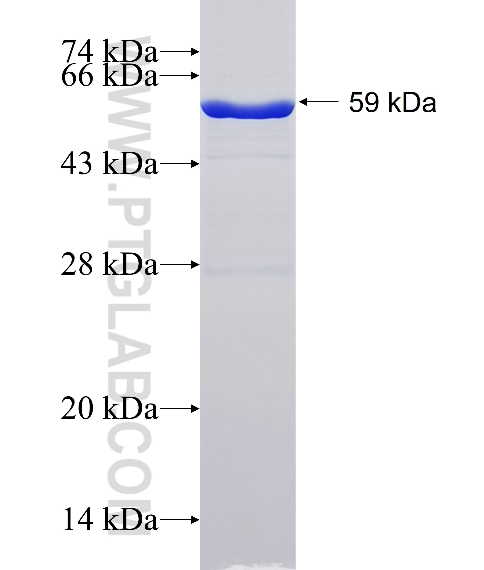 EIF2S1 fusion protein Ag1645 SDS-PAGE