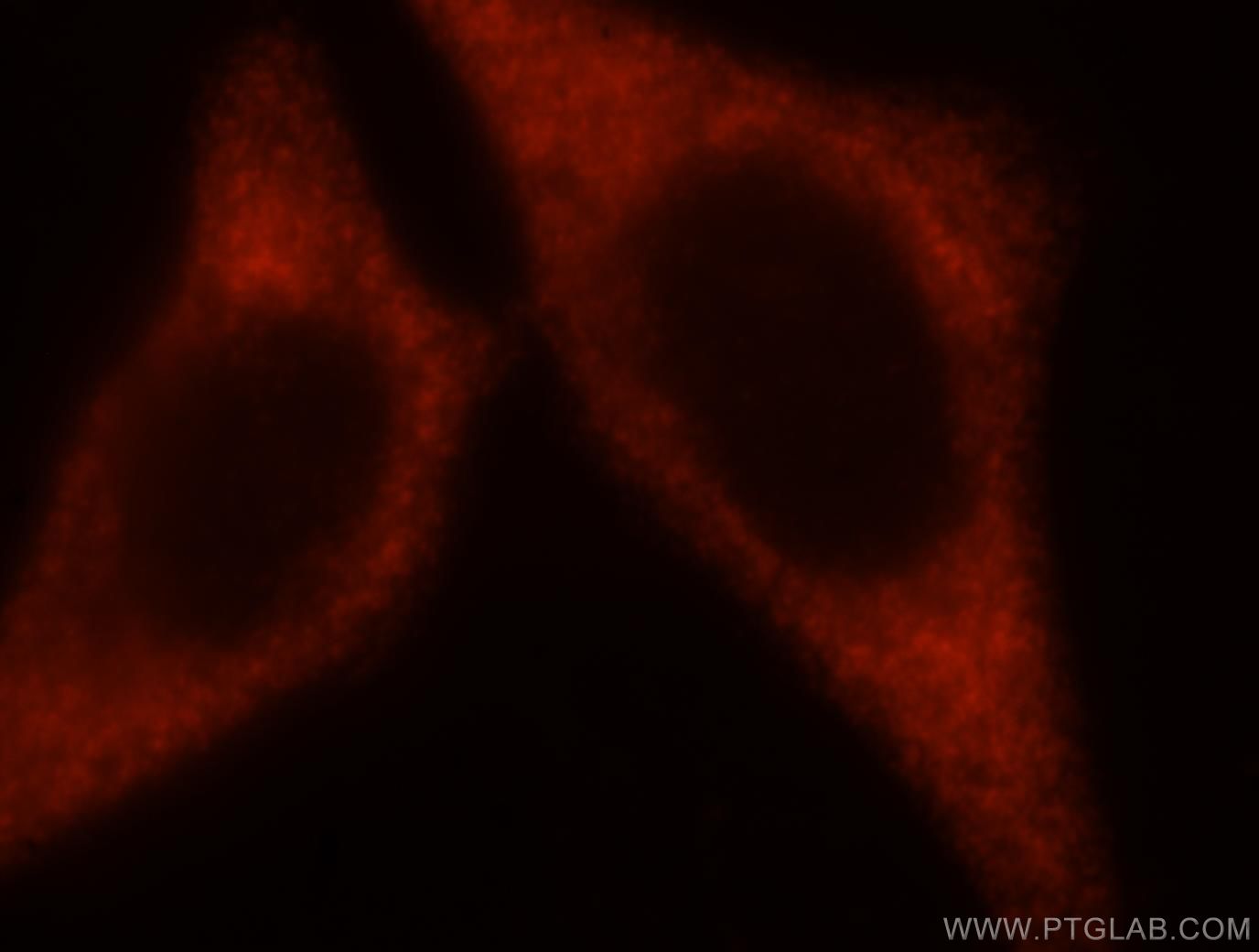 IF Staining of HepG2 using 10227-1-AP