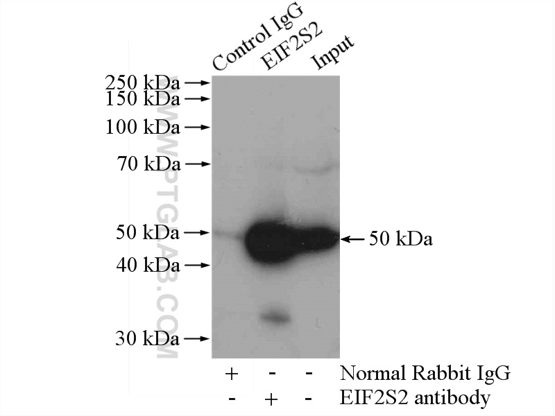 IP experiment of mouse liver using 10227-1-AP