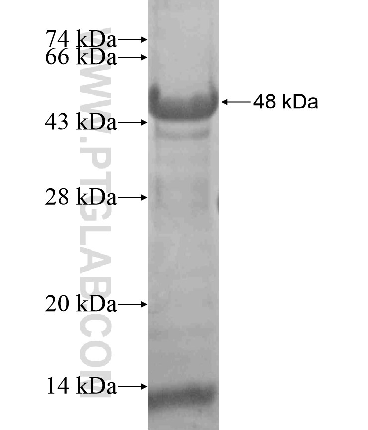 EIF2S2 fusion protein Ag18349 SDS-PAGE