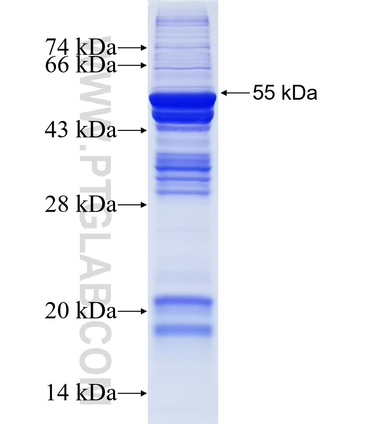 EIF2S3 fusion protein Ag1650 SDS-PAGE