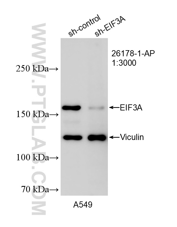 WB result of EIF3A antibody (26178-1-AP; 1:3000; incubated at room temperature for 1.5 hours) with sh-Control and sh-EIF3A transfected A549 cells. WB analysis of A549 using 26178-1-AP