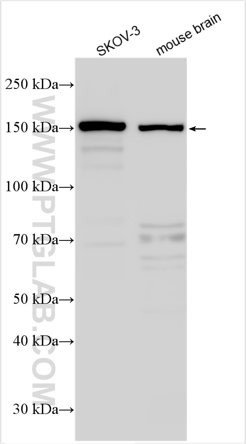 WB analysis using 27665-1-AP
