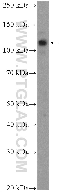 WB analysis of A375 using 10319-1-AP