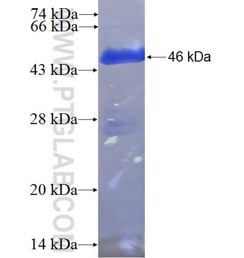 EIF3B fusion protein Ag0386 SDS-PAGE
