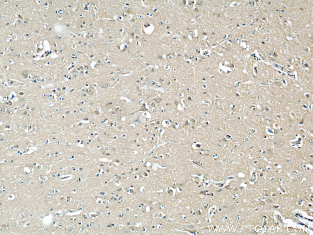 IHC staining of human brain using 66024-1-Ig