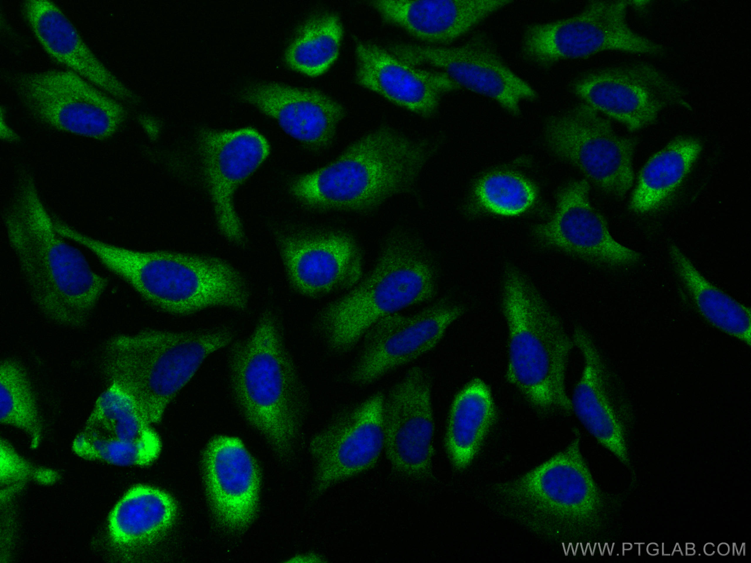 IF Staining of U2OS using 82512-1-RR (same clone as 82512-1-PBS)