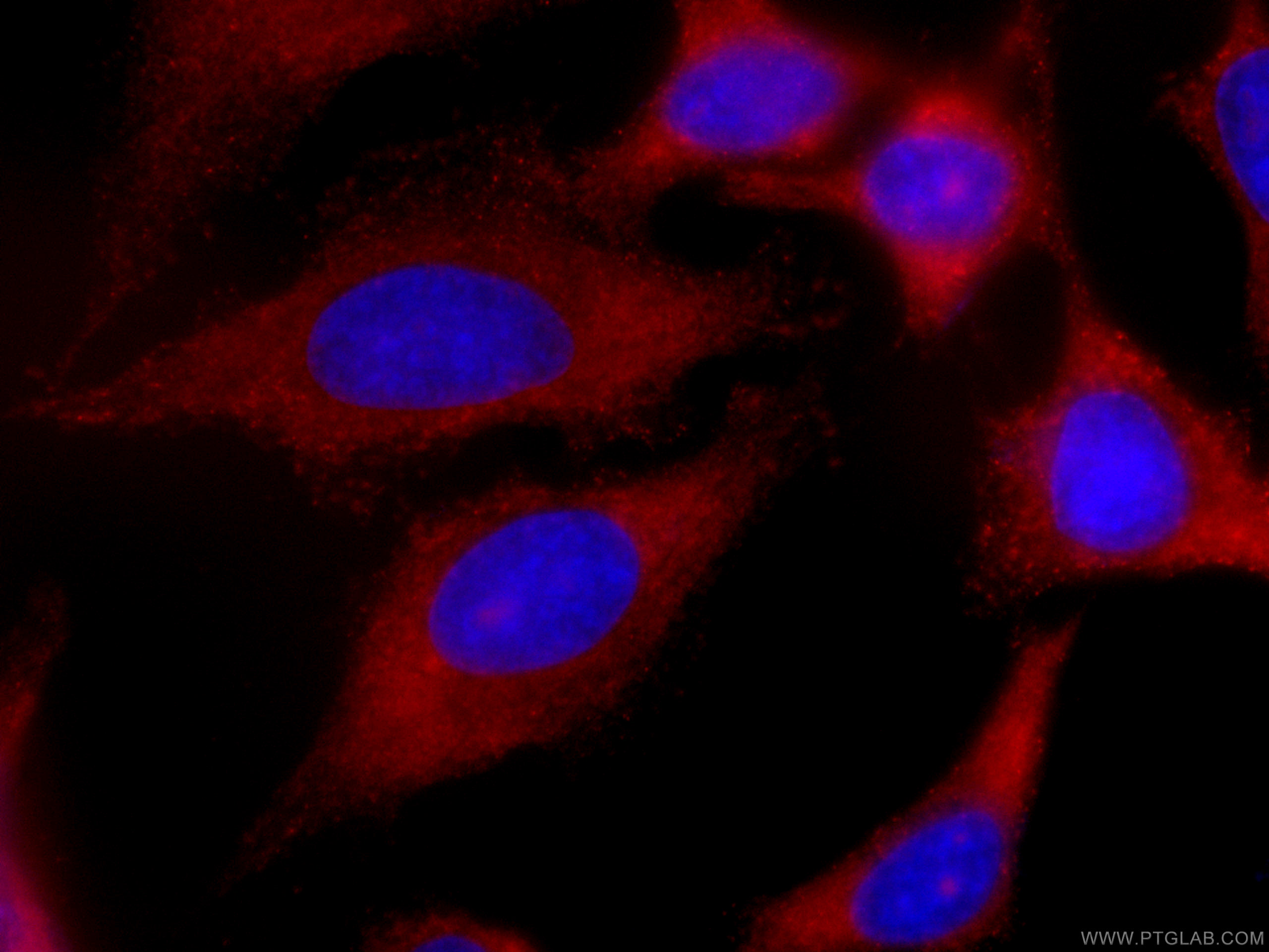 IF Staining of HeLa using CL594-66024