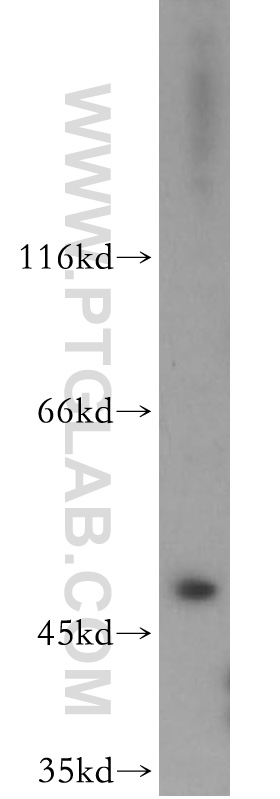 WB analysis of HeLa using 11352-1-AP