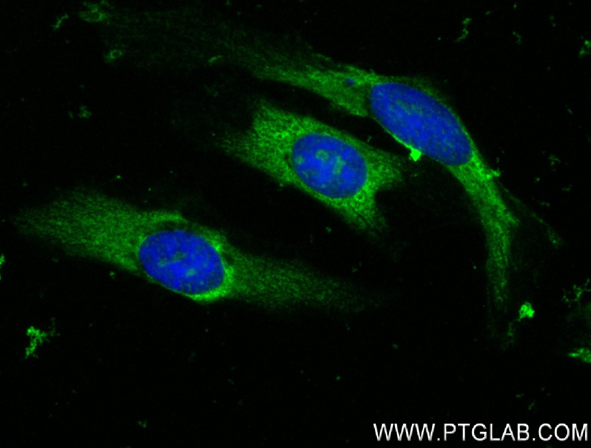 IF Staining of HeLa using 84131-2-RR