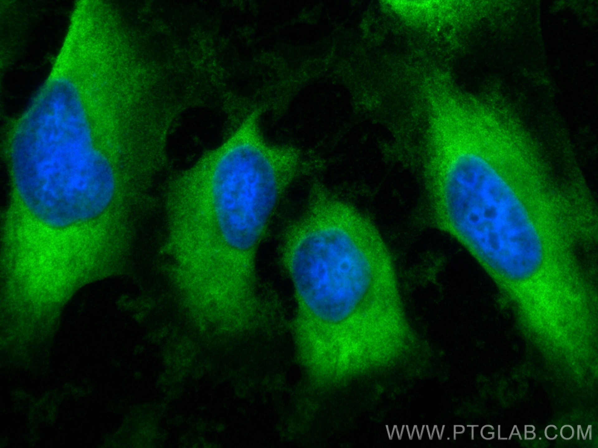 IF Staining of HeLa using 84131-2-RR