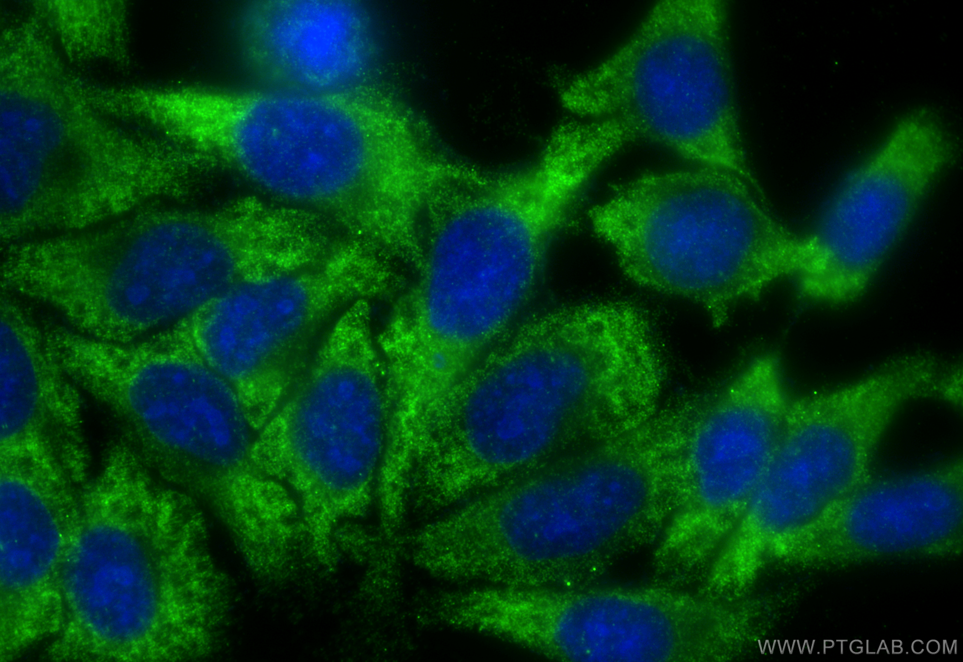 IF Staining of HepG2 using 11165-1-AP