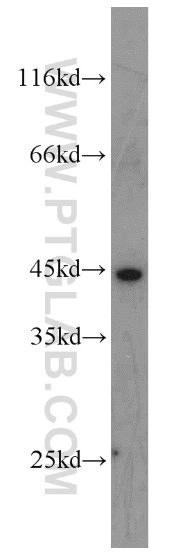 WB analysis of HepG2 using 11165-1-AP