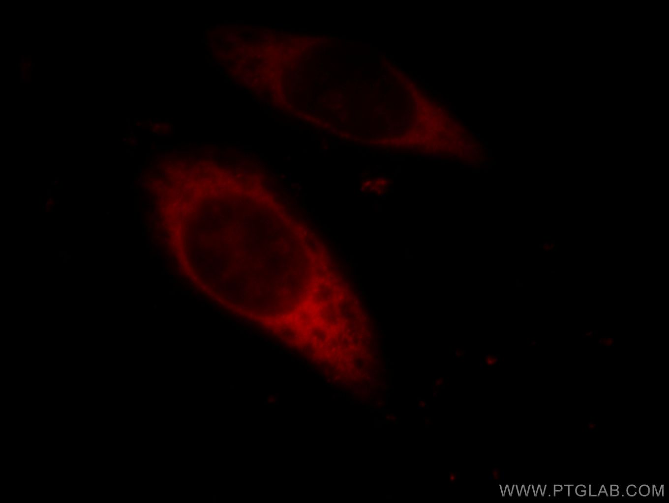 IF Staining of HeLa using 11287-1-AP