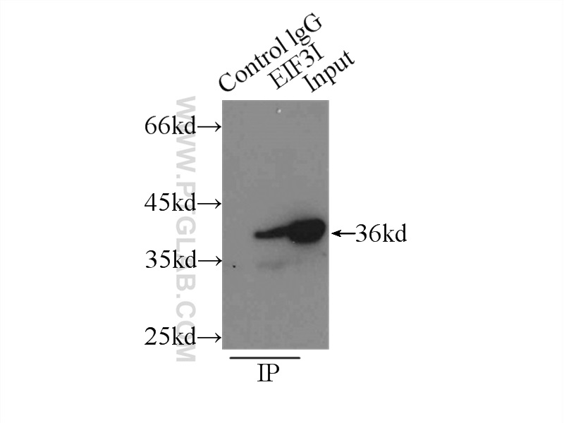 IP experiment of HEK-293 using 11287-1-AP