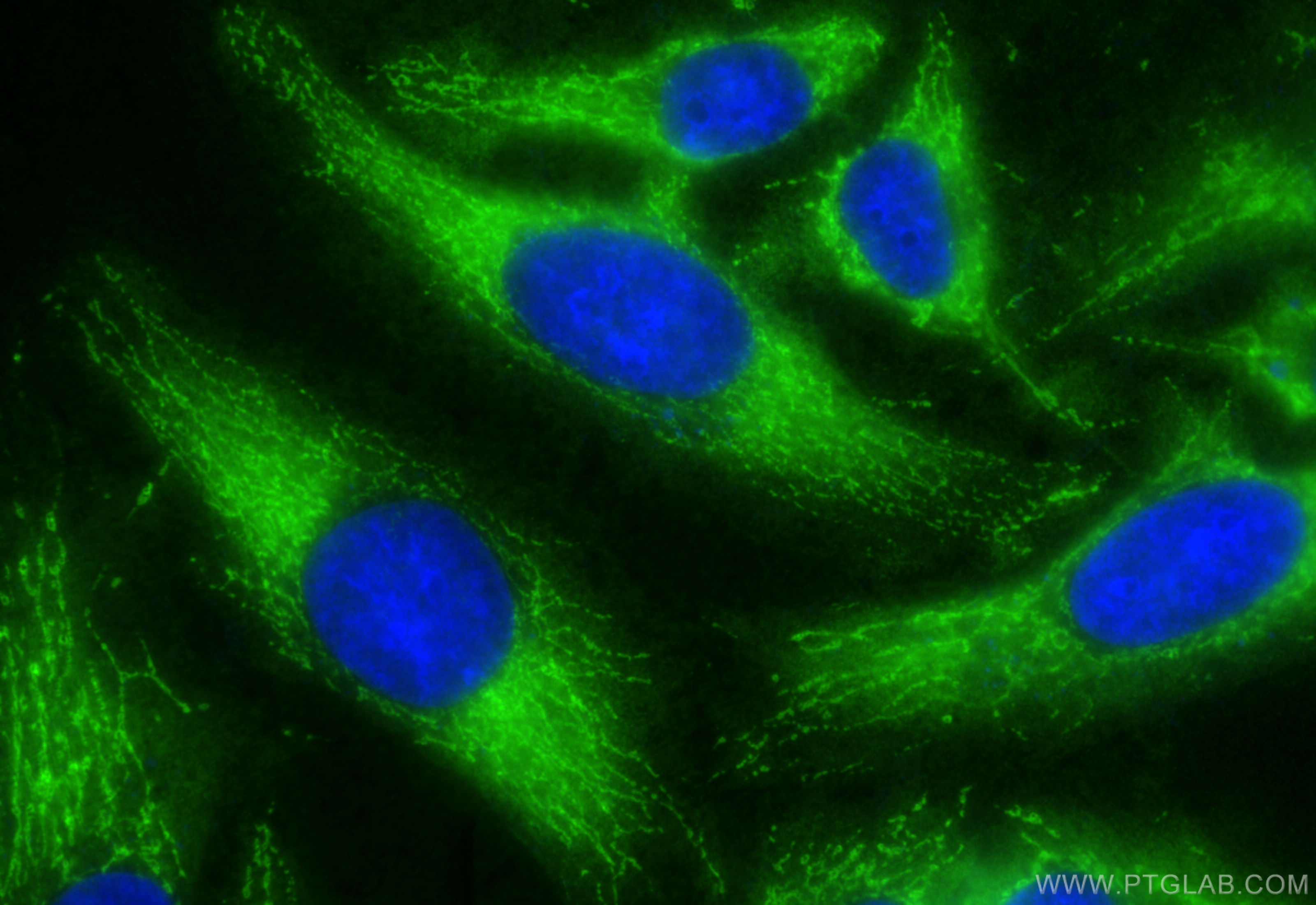 IF Staining of HeLa using 10439-1-AP